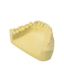 Kulzer - Moldano - Hard Plaster Type 3 - Yellow - (25 kg)