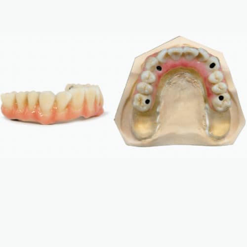 highly-aesthetic-full-arch-restorations