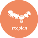 exoplan