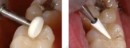 dura_white