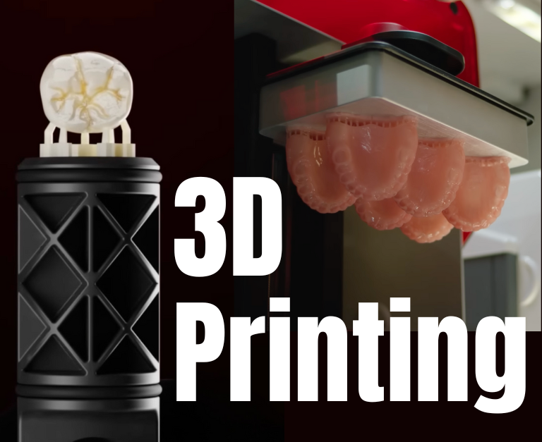 3D printing Improdent